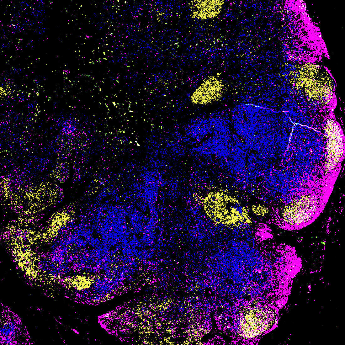 Lymph node, fluorescent light micrograph