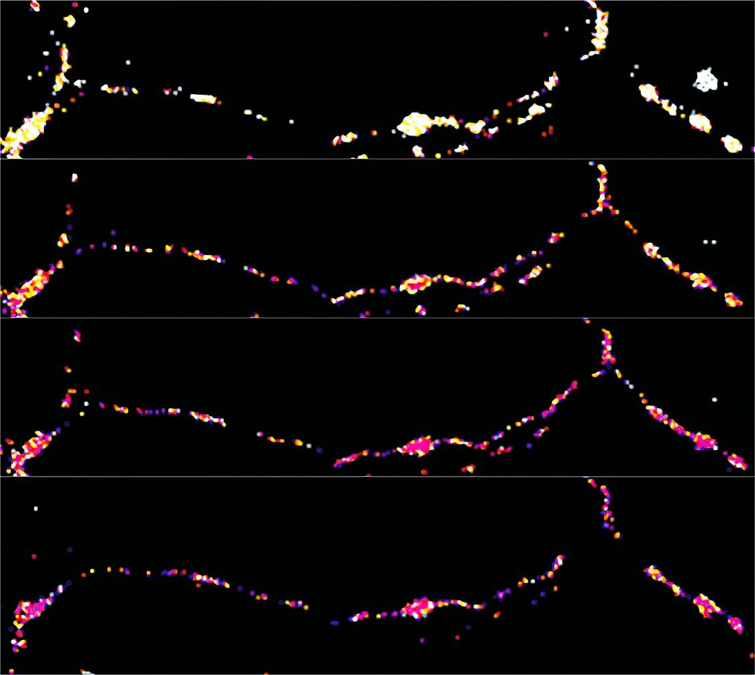 Neural communication, fluorescent light micrograph