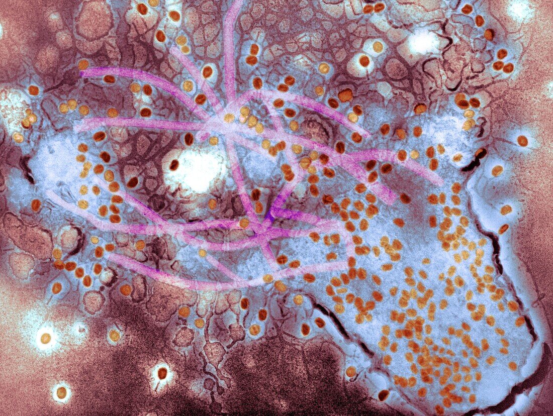 Bacterial lysis due to T4 phage infection, TEM