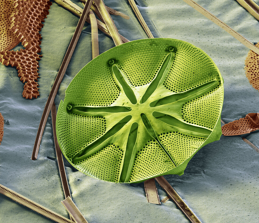 Asteromphalus sp. diatom, SEM