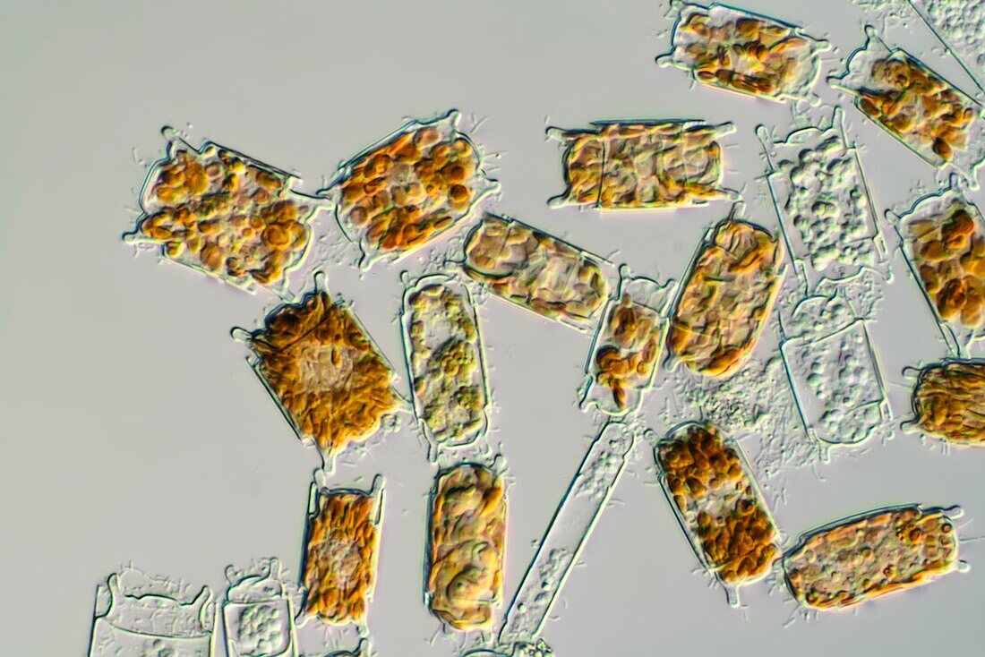 Odontella sp. diatom, light micrograph