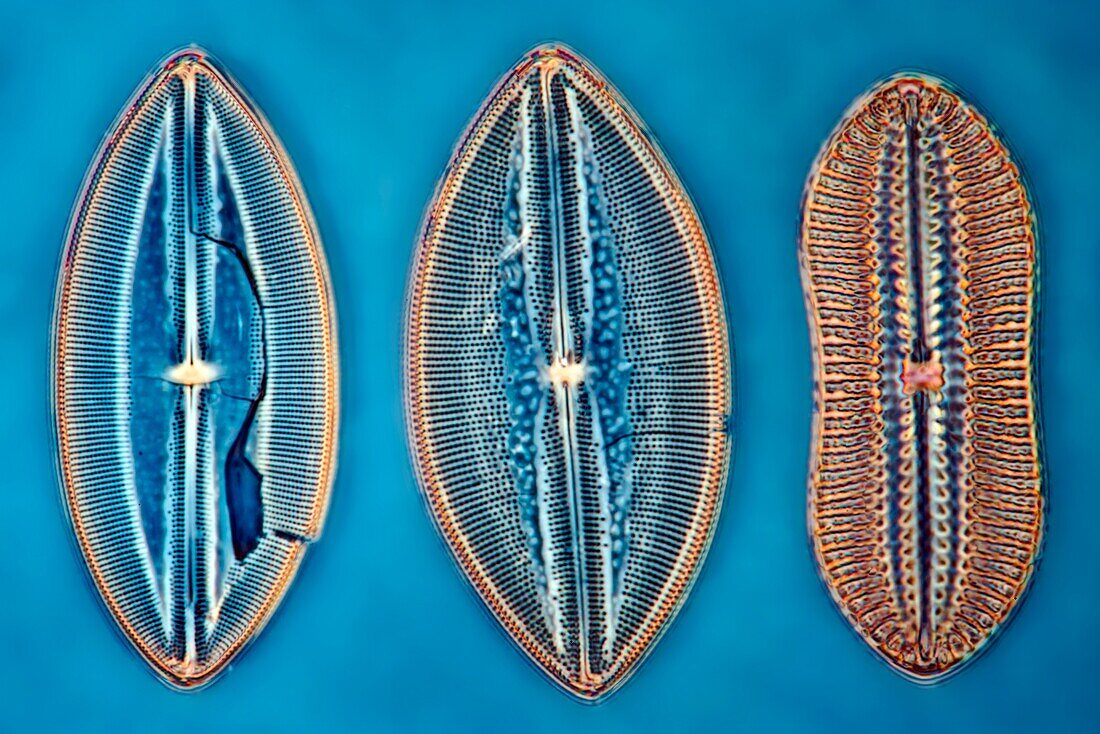 Fossil diatom, light micrograph