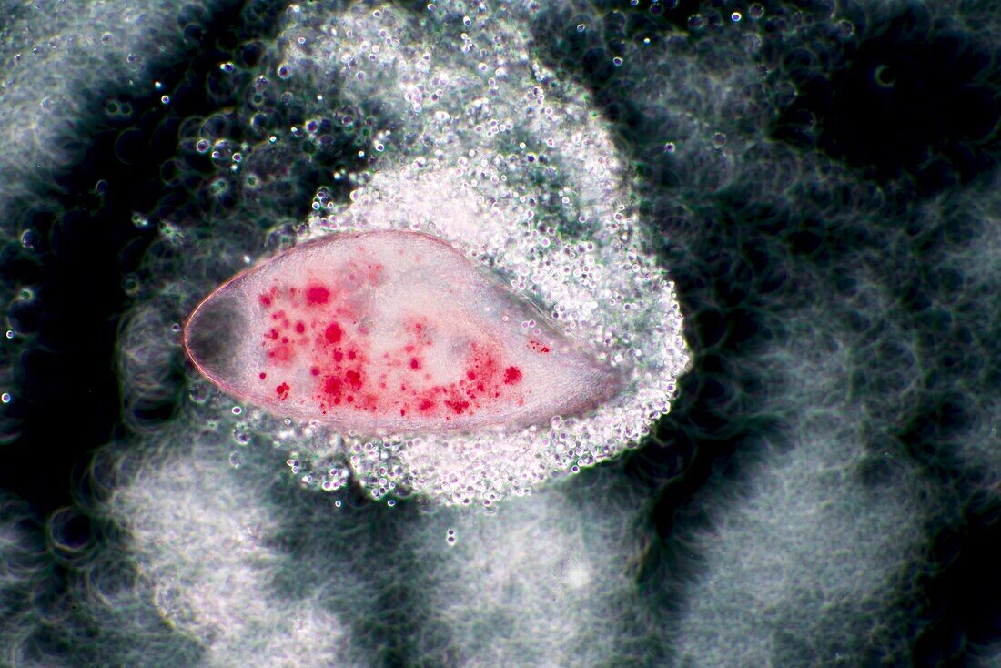 Blepharisma americana protozoan, light micrograph