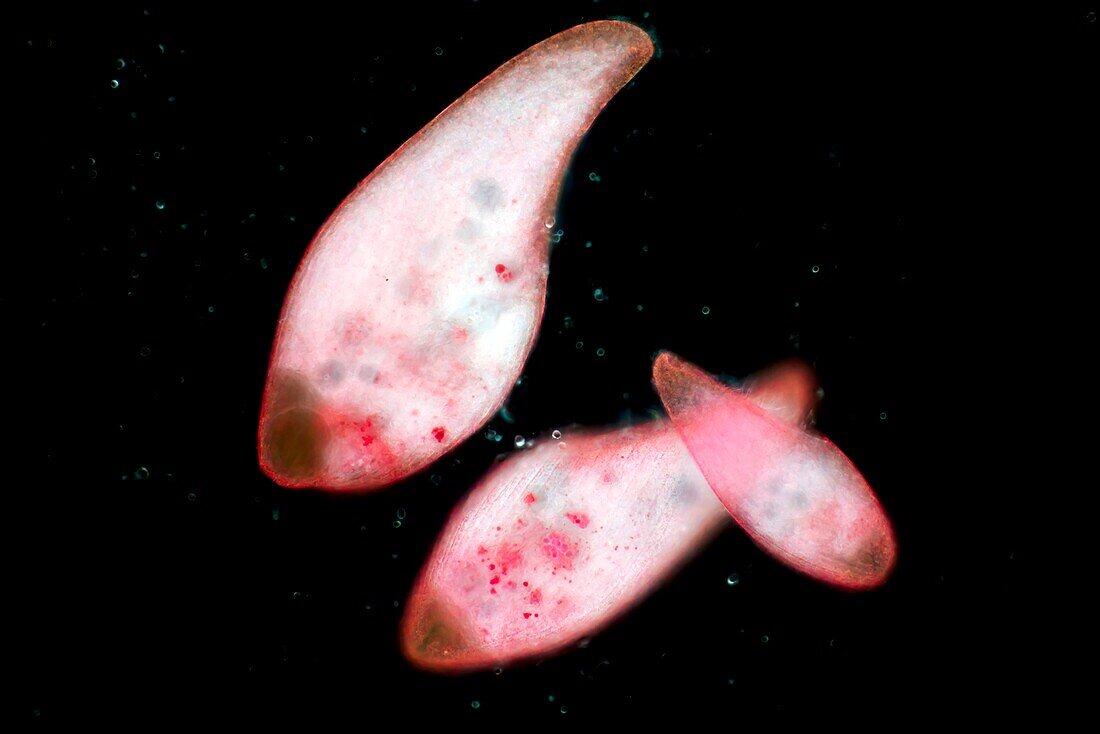 Blepharisma americana protozoan, light micrograph