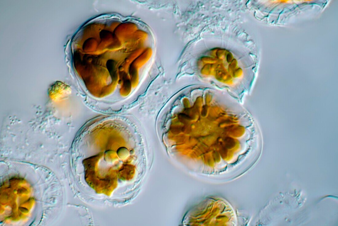 Campylodiscus sp. diatoms, light micrograph