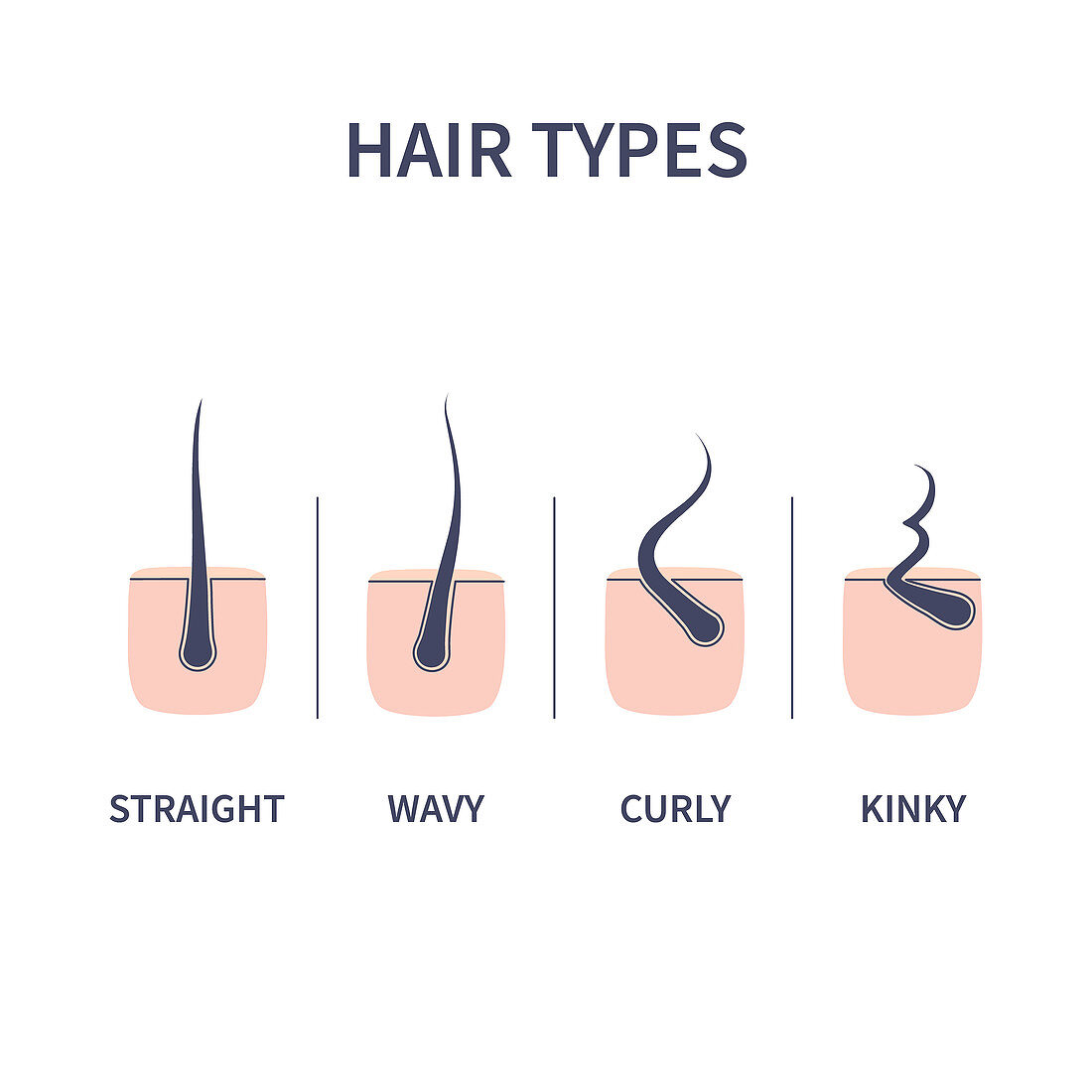 Hair types, illustration