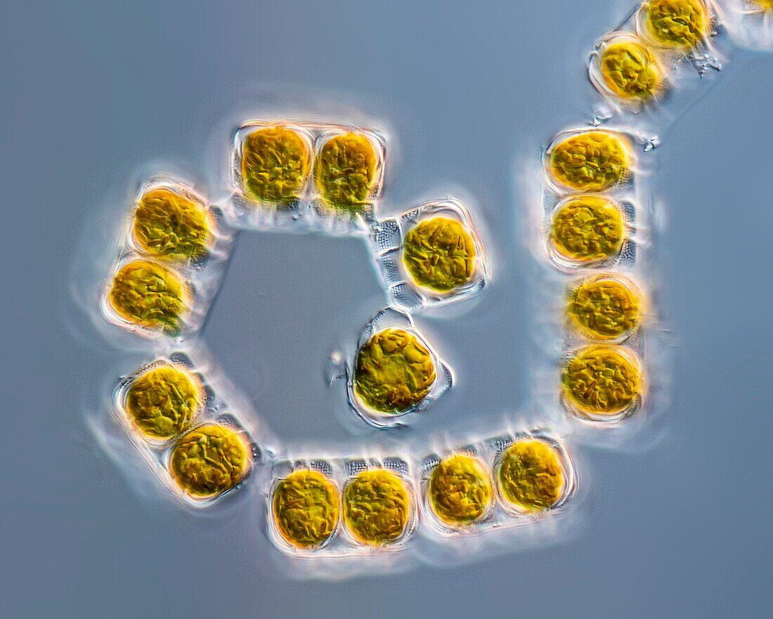 Biddulphia diatoms, LM