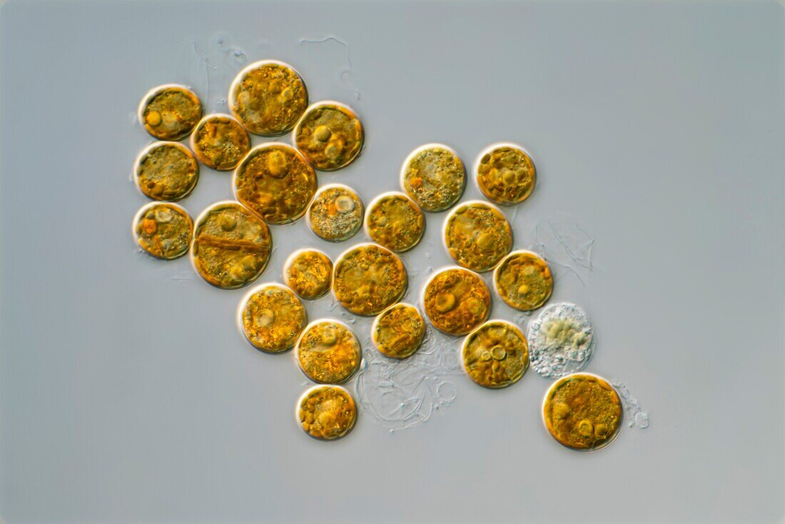 Symbiodinium dinoflagellates, light micrograph