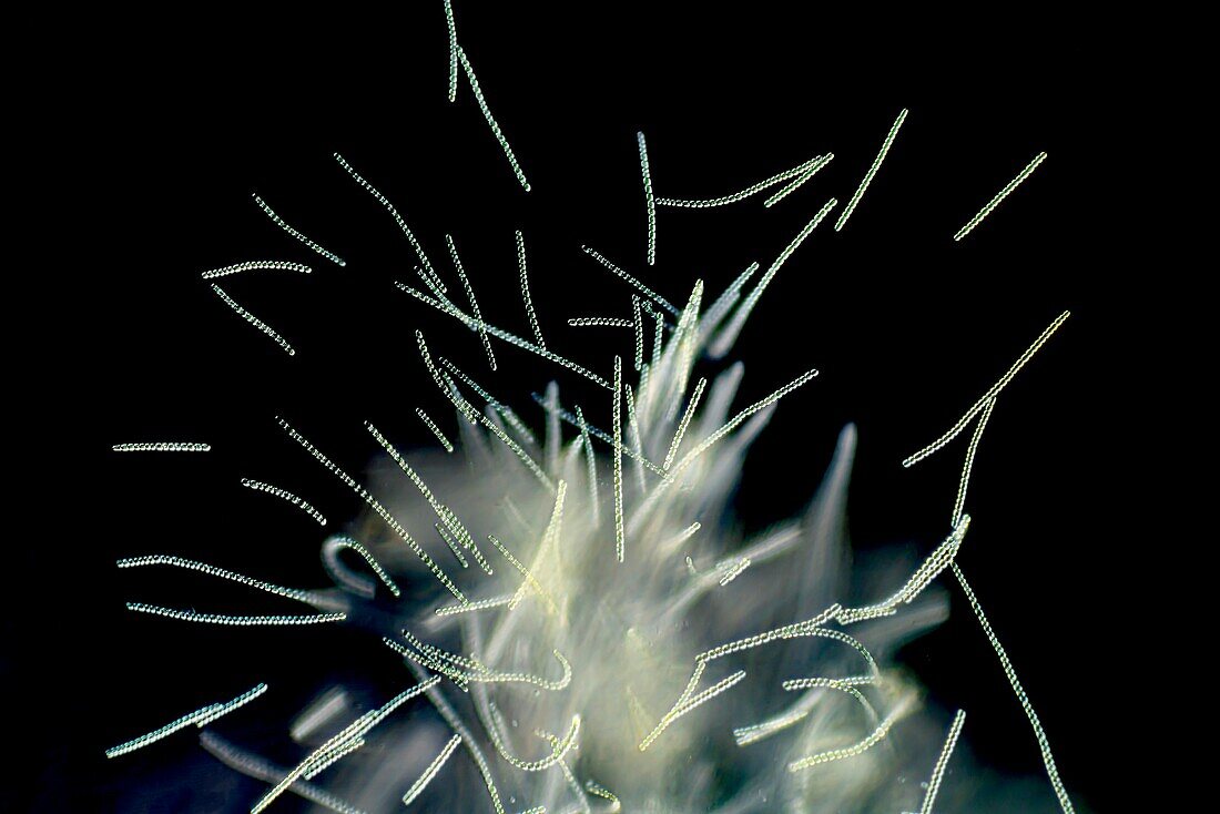 Anabaena cyanobacteria, light micrograph