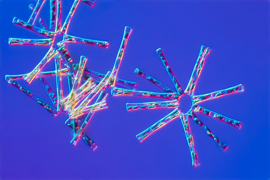Asterionella diatoms, light micrograph