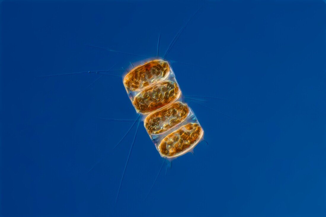 Thalassiosira sp. diatom, light micrograph