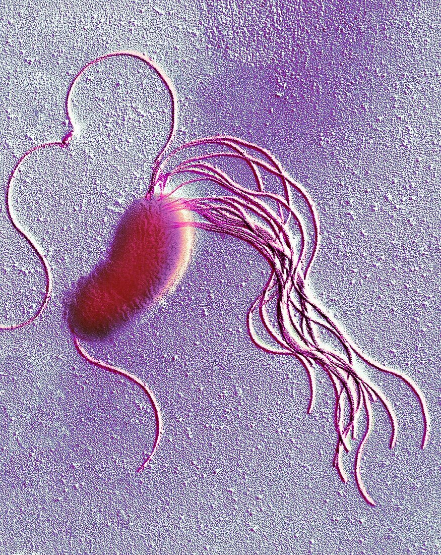 Pseudomonas fluorescens bacterium, TEM