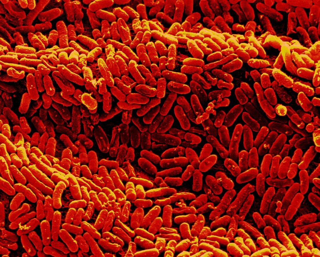 Escherichia coli bacteria, SEM