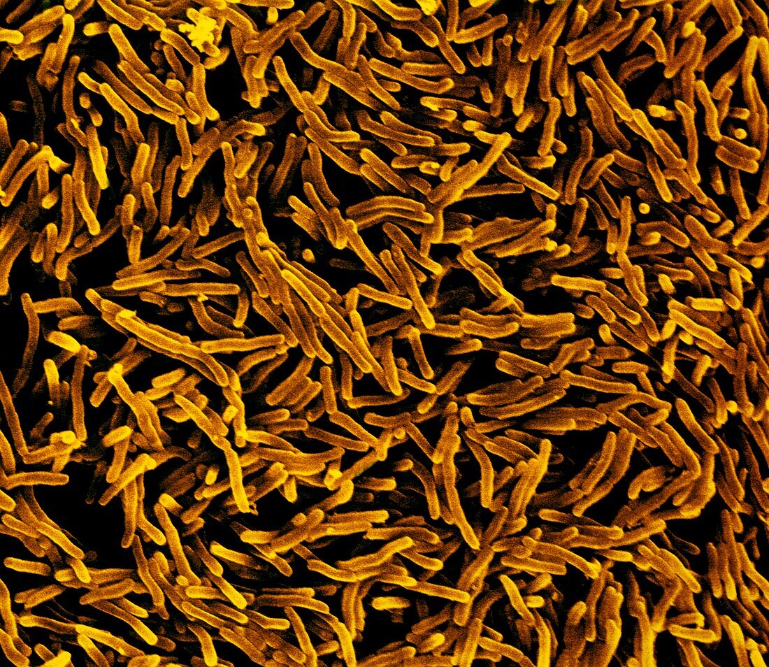 Mycobacterium tuberculosis bacteria, SEM