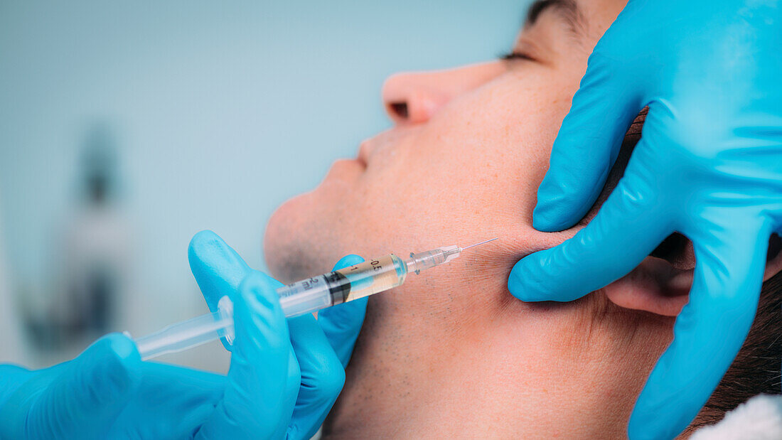 Dermal fillers jawline injection