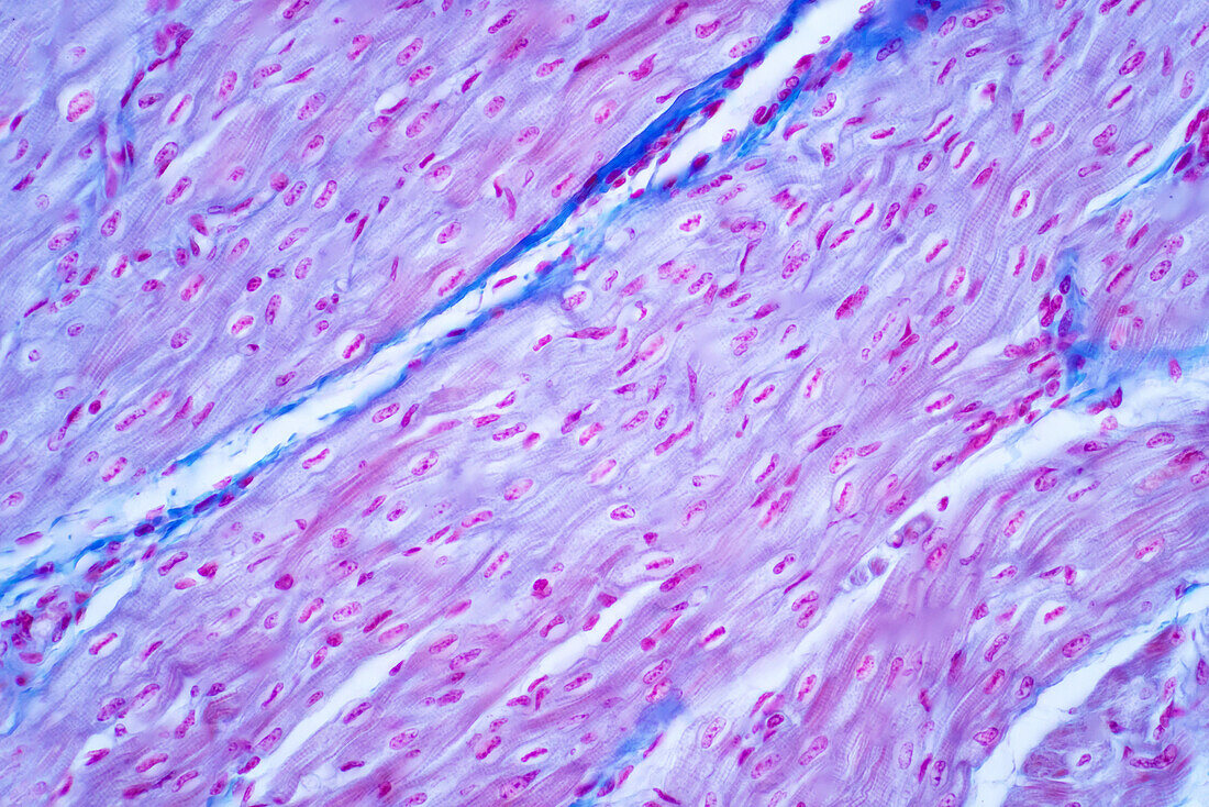 Human cardiac muscle, light micrograph