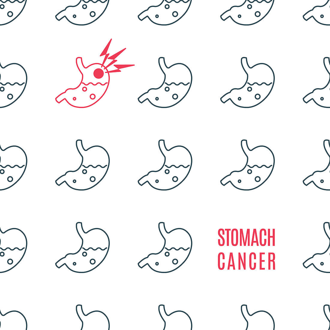 Stomach cancer, conceptual illustration