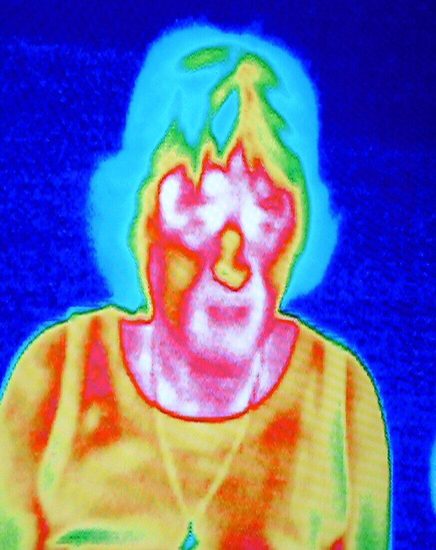 Thermal image of a child