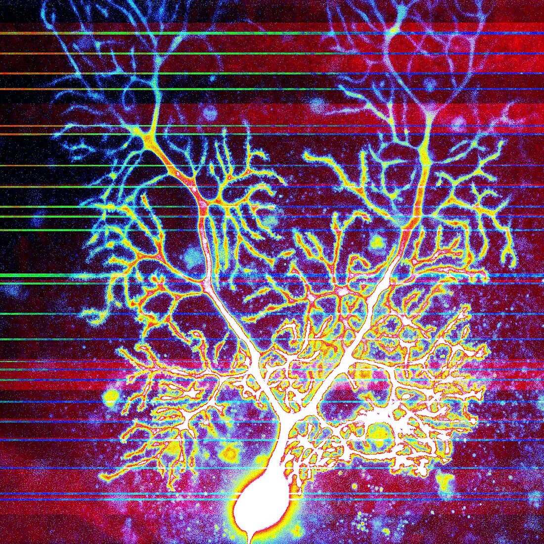 Purkinje nerve cell, confocal micrograph
