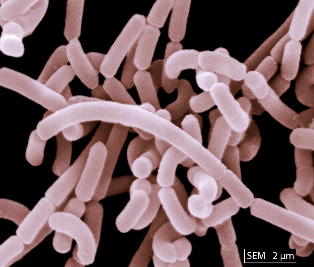 Lactobacillus acidophilus bacteria, SEM