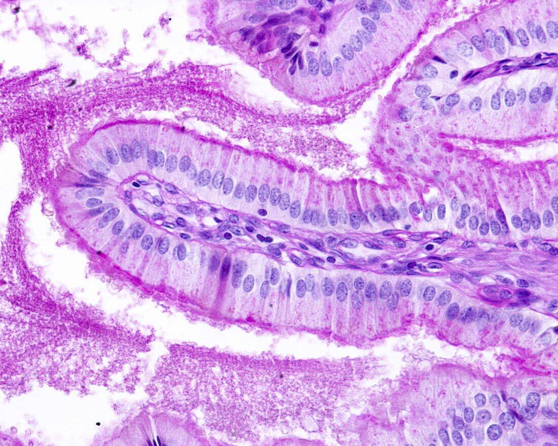 Gallbladder epithelium, light micrograph