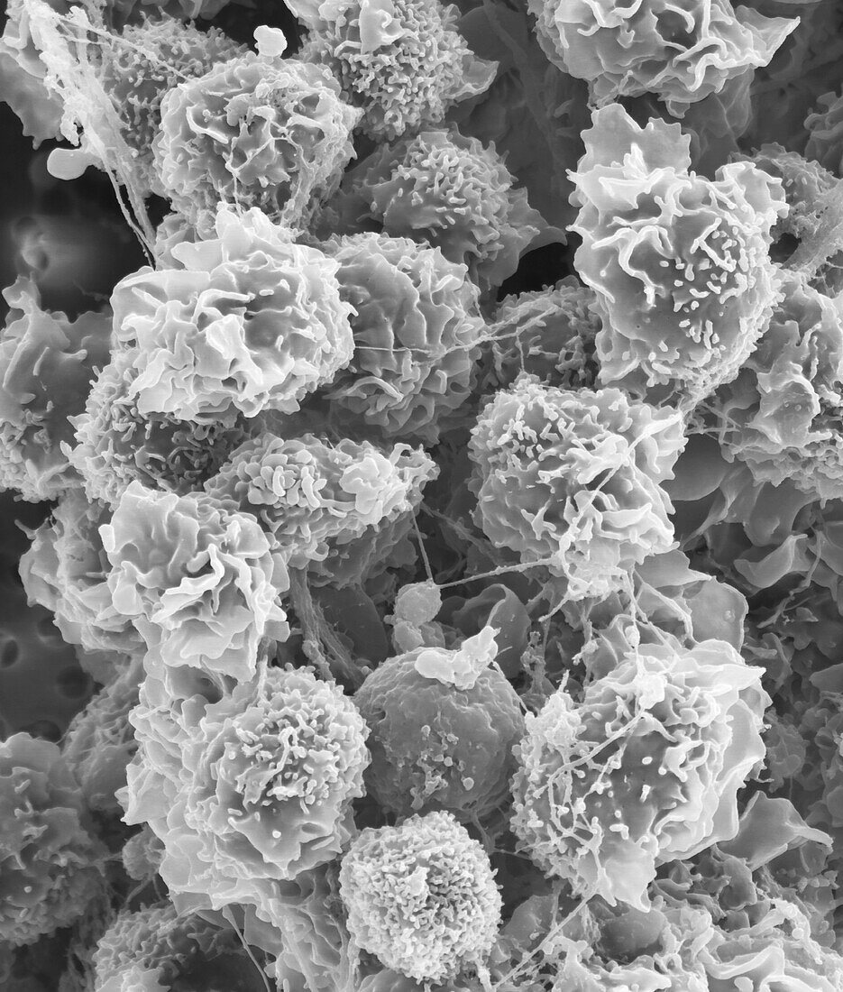 Tissue macrophages, SEM