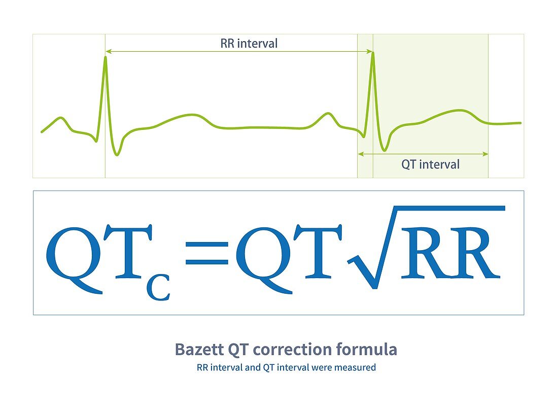 Bazett QT correction formula, illustration