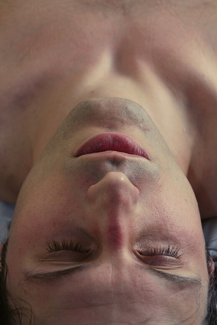 Young man receiving acupuncture treatment