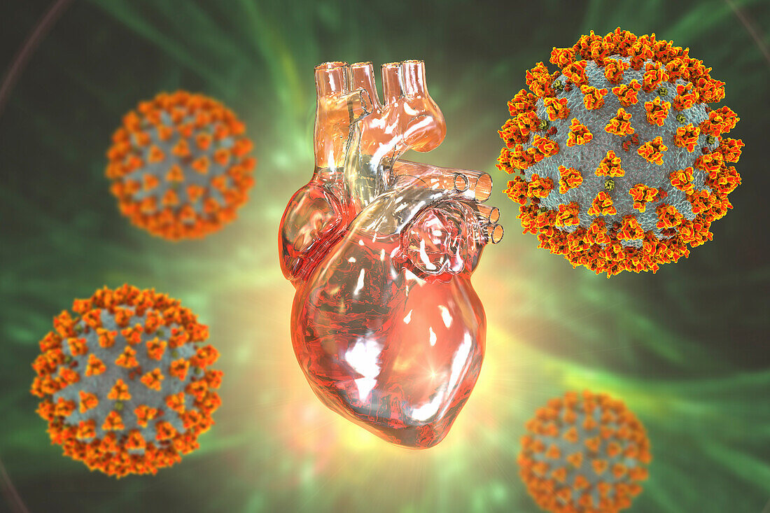 Covid-19 viruses affecting the heart, illustration