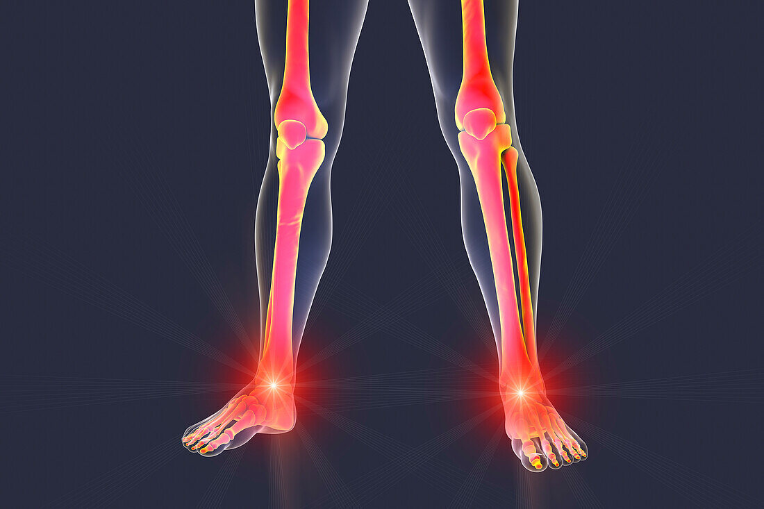 Painful ankle and knee, illustration