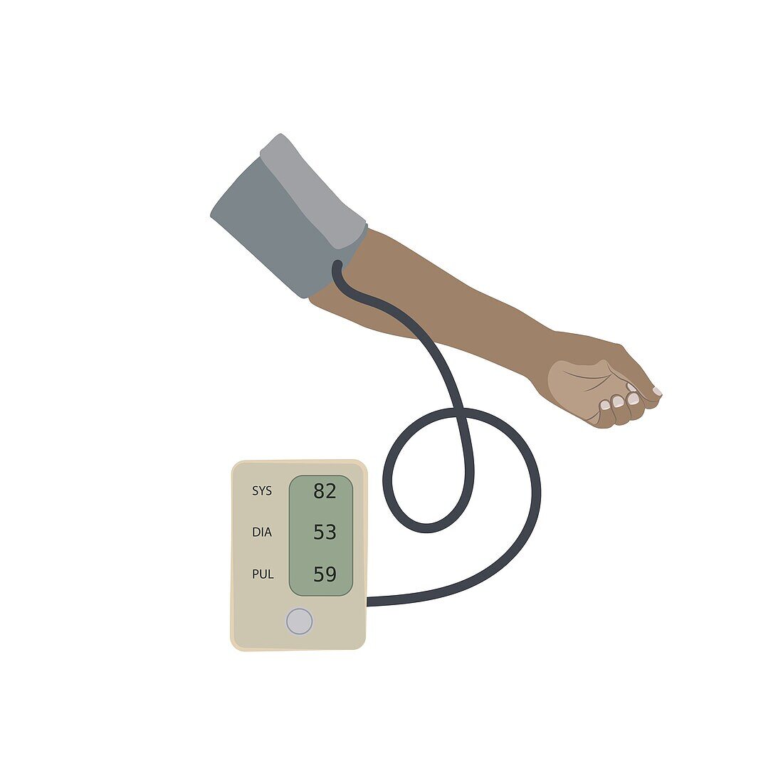 Low blood pressure, illustration