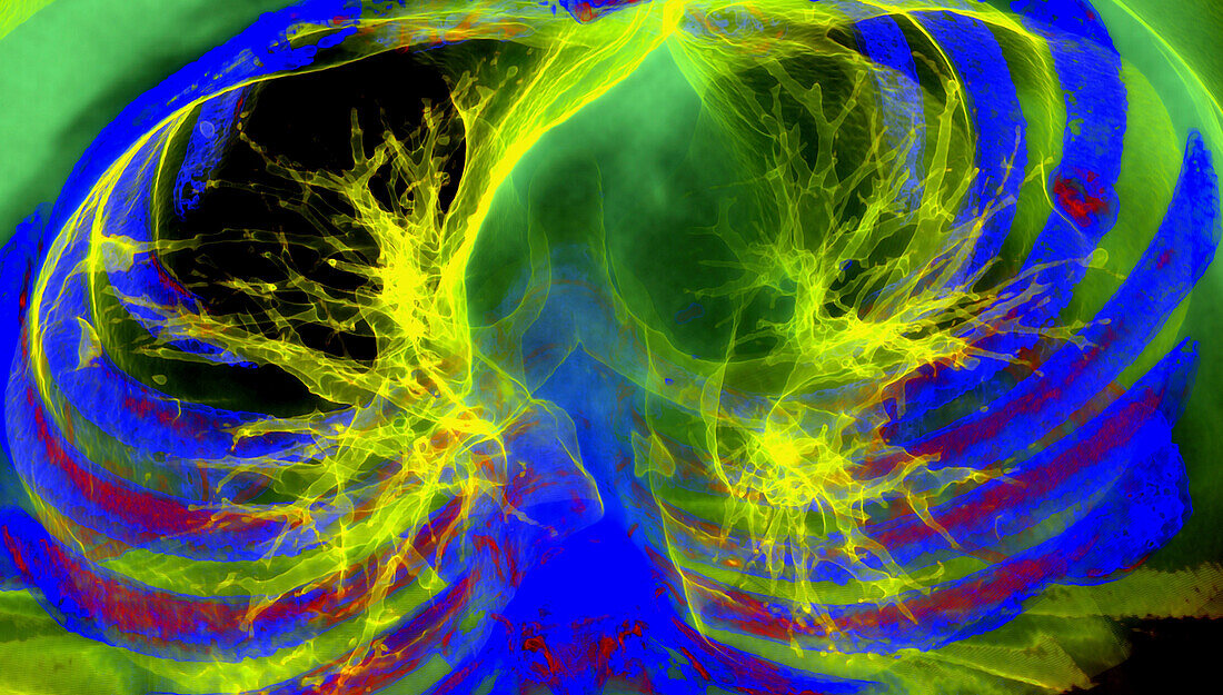 Healthy heart and lungs, 3D CT scan