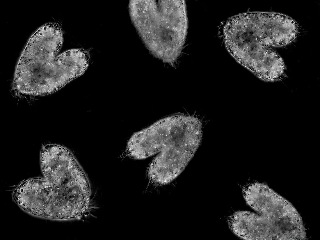 Cell division of Oxytricha protozoa, light micrograph