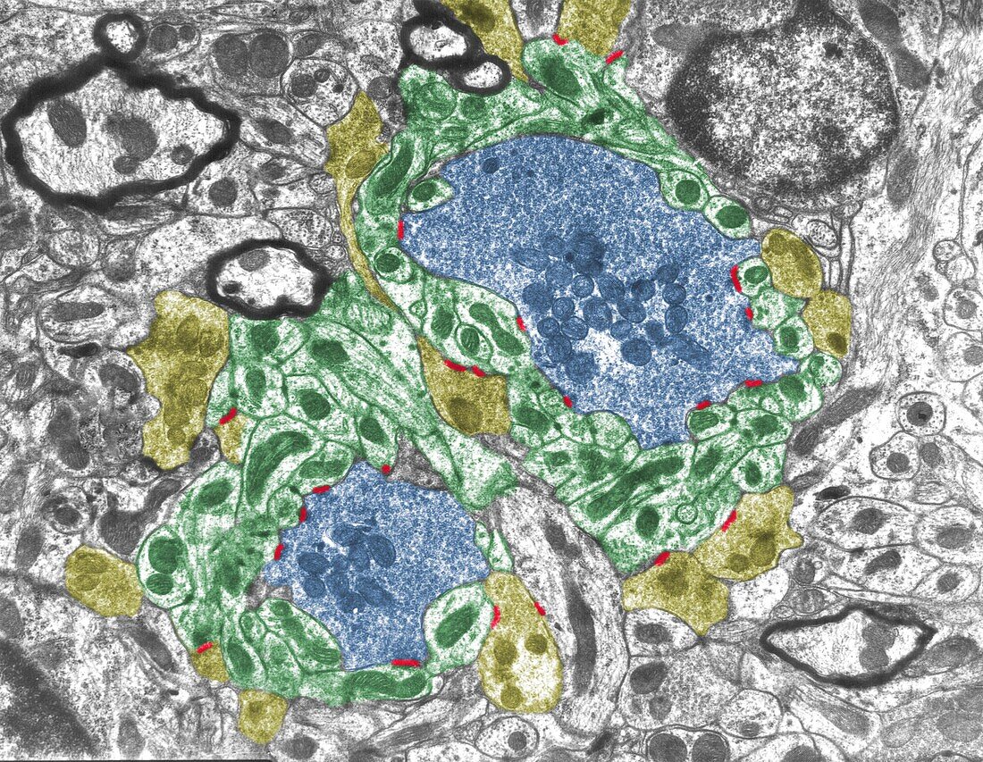 Cerebellar glomerulus, TEM