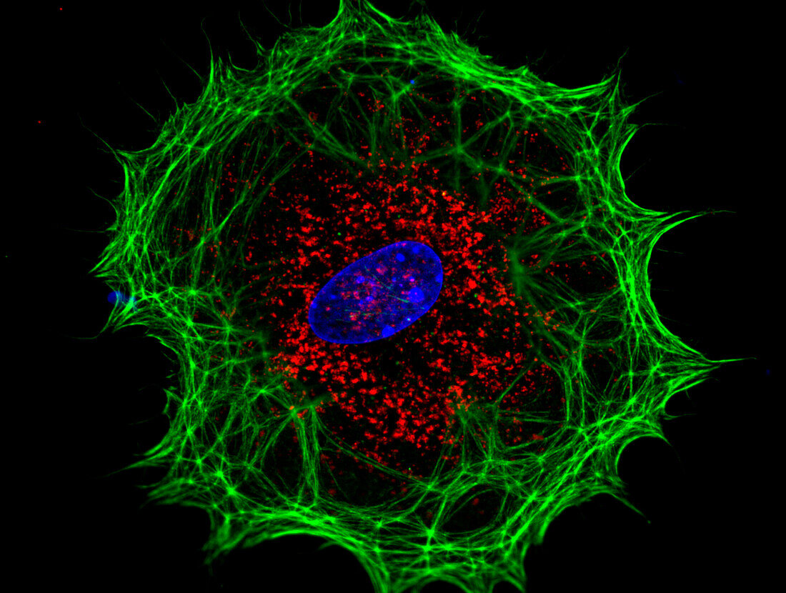 Fibroblast, fluorescent micrograph