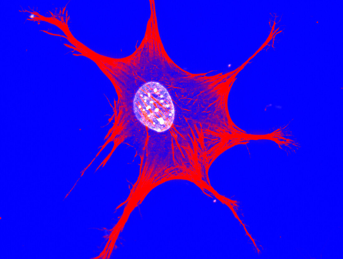 Fibroblast, fluorescent micrograph