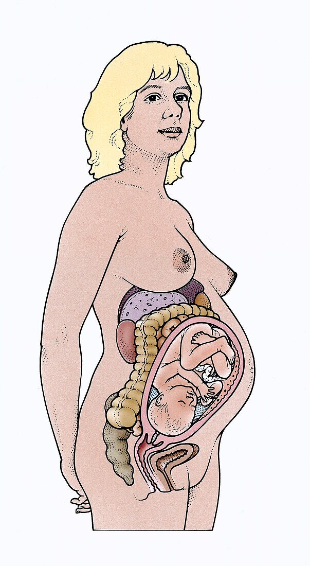 Changing shape of a pregnant woman, illustration