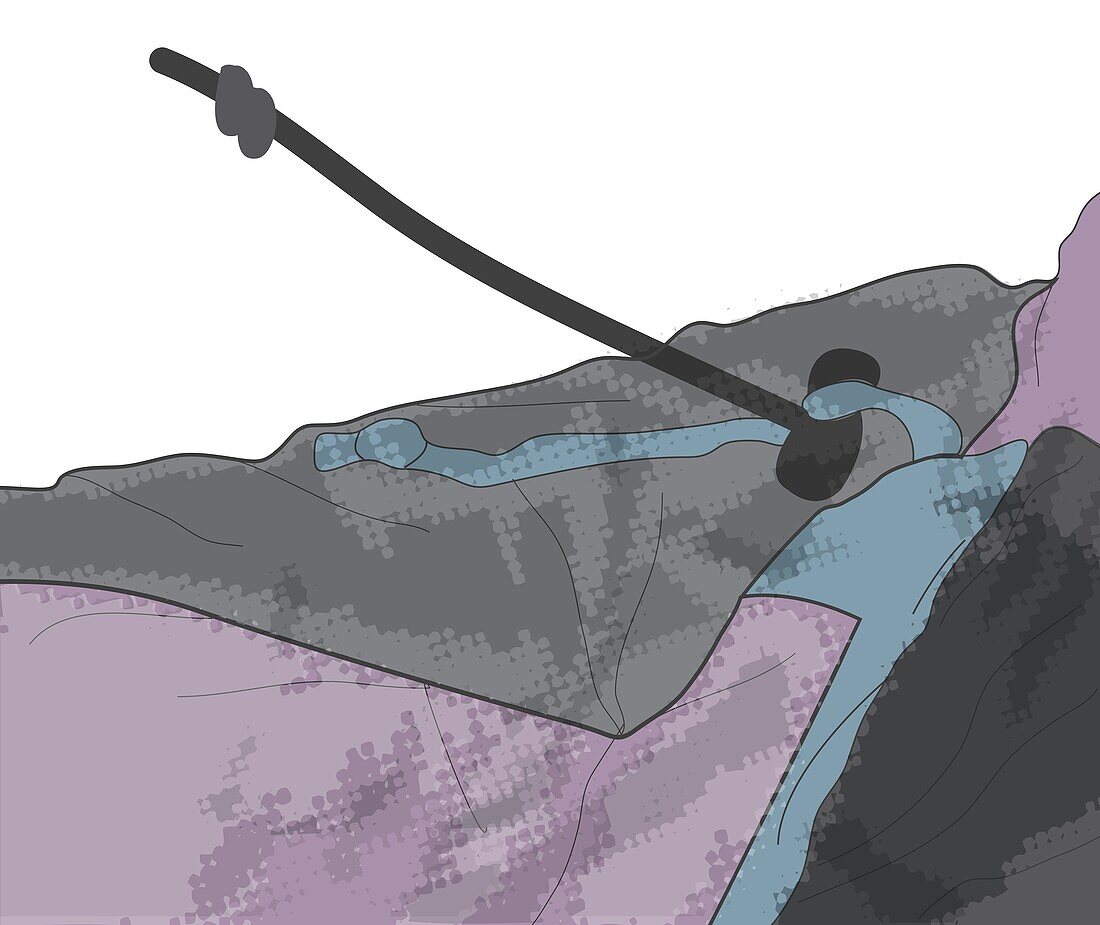 Locking mechanism on sleeping bag, illustration