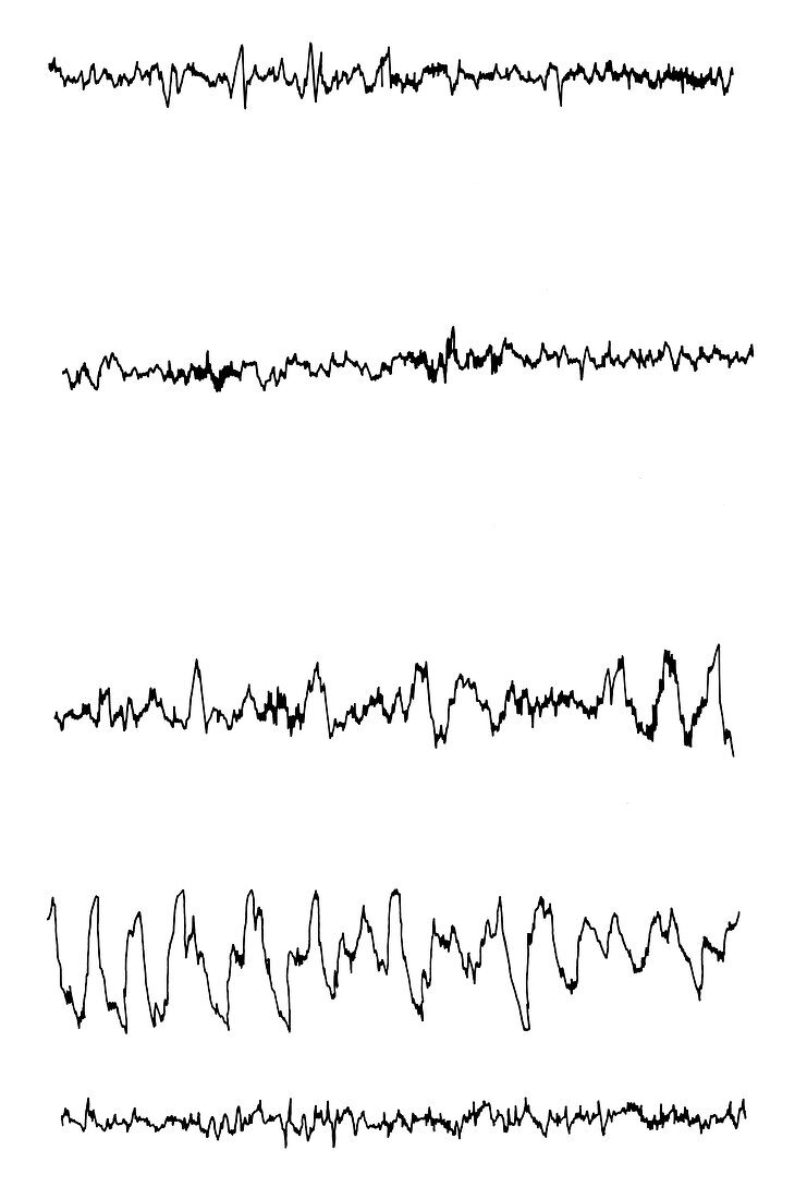 Path to deep sleep EEG waves