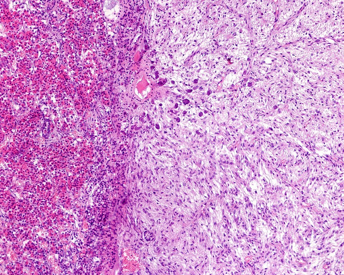 Intermediate lobe of pituitary gland, light micrograph