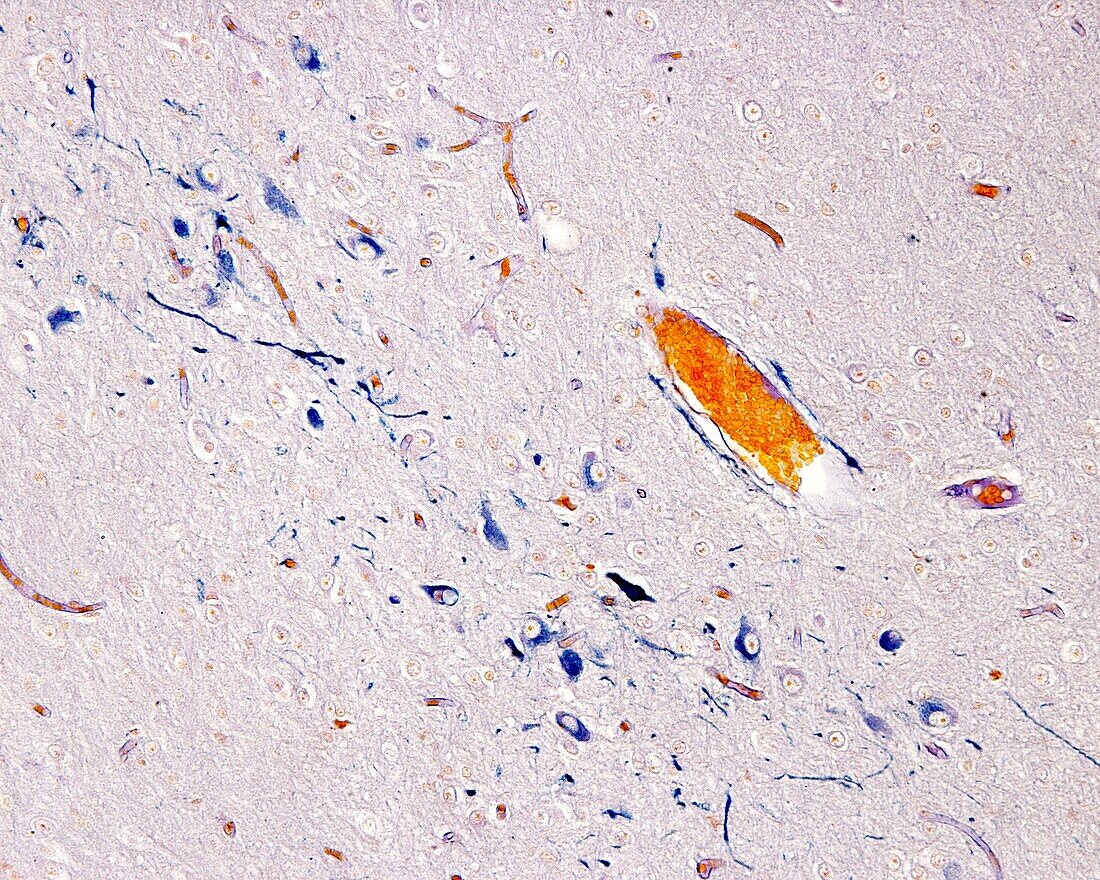 Hypothalamus paraventricular nucleus, light micrograph