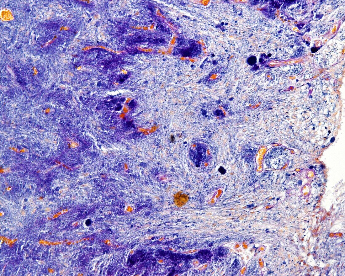 Posterior pituitary gland, light micrograph