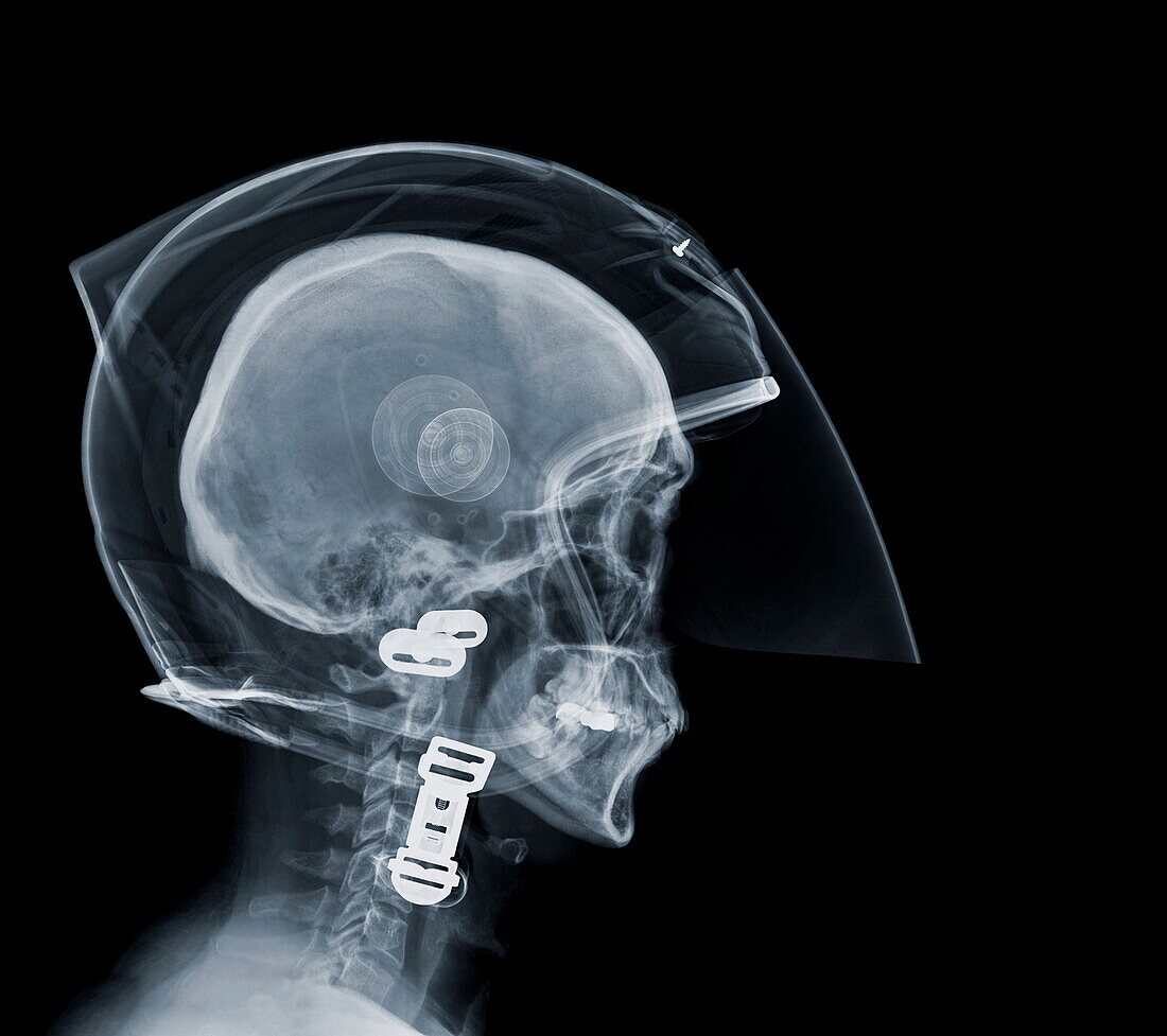 Person wearing a motorcycle helmet, X-ray