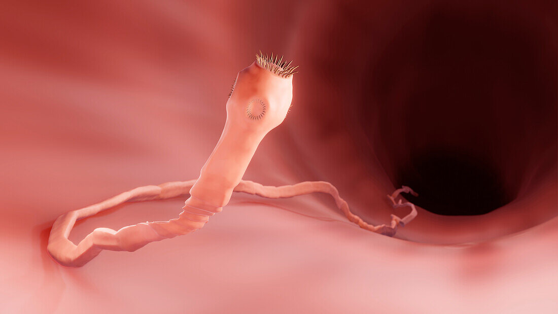 Tapeworm in the intestine, illustration