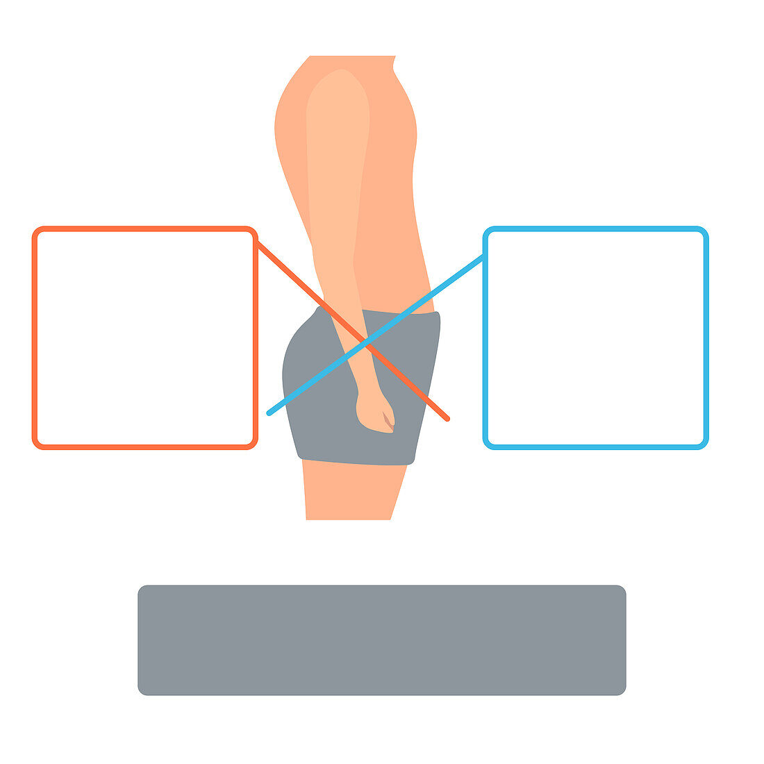 Lower crossed syndrome, conceptual illustration