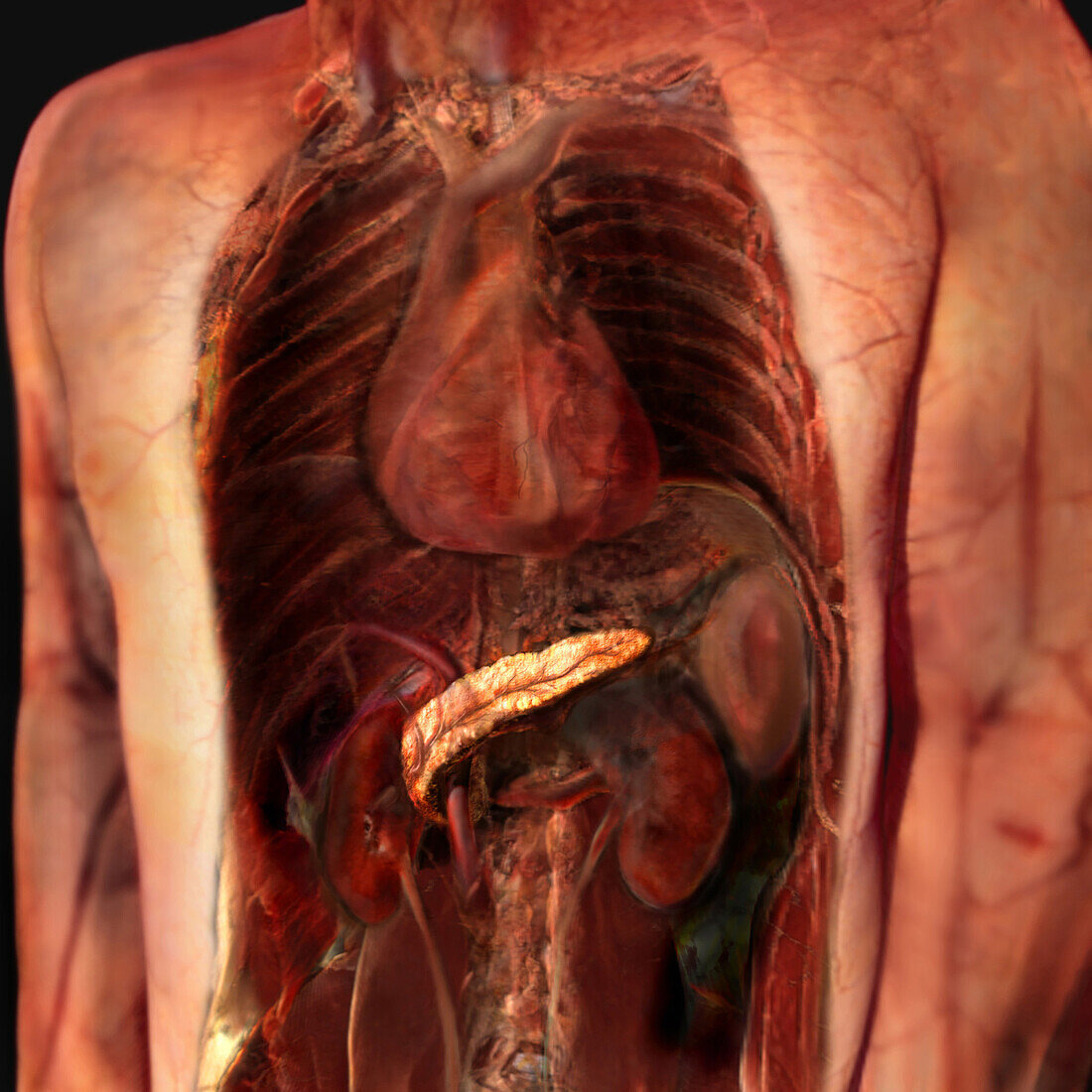 Sectioned Abdomen Showing Pancreas