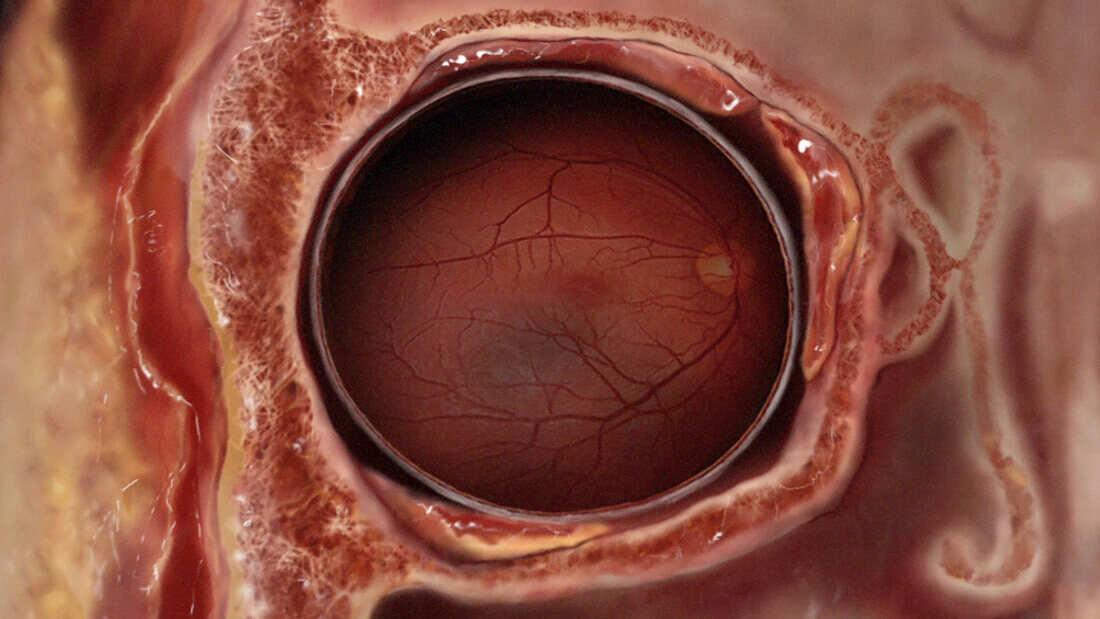 Eye, Coronal Section