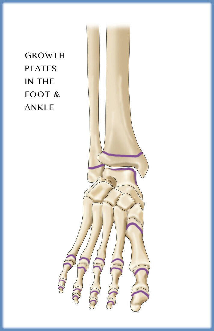 Foot Growth Plates, Illustration
