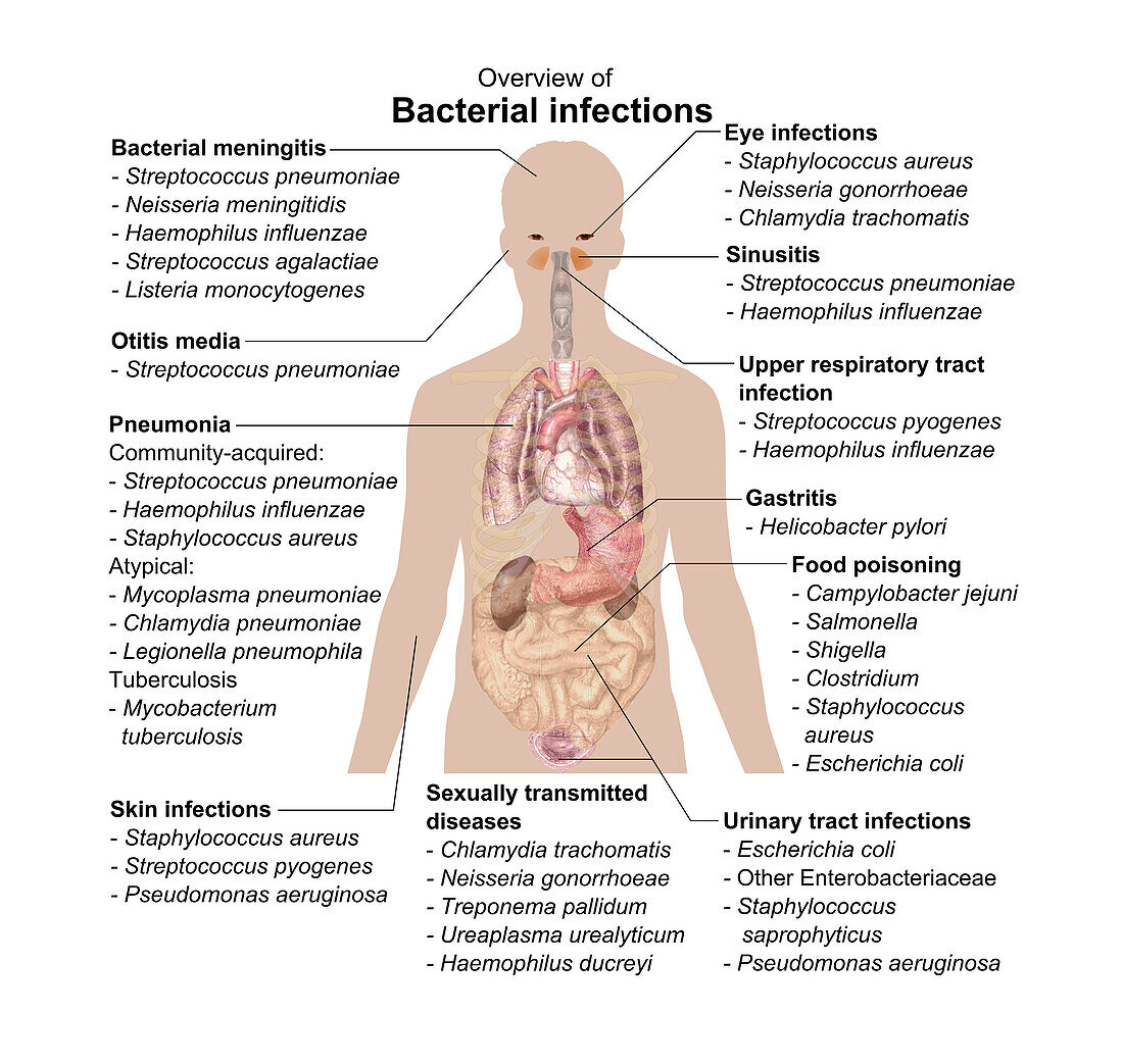Main Bacterial Infections, Illustrations