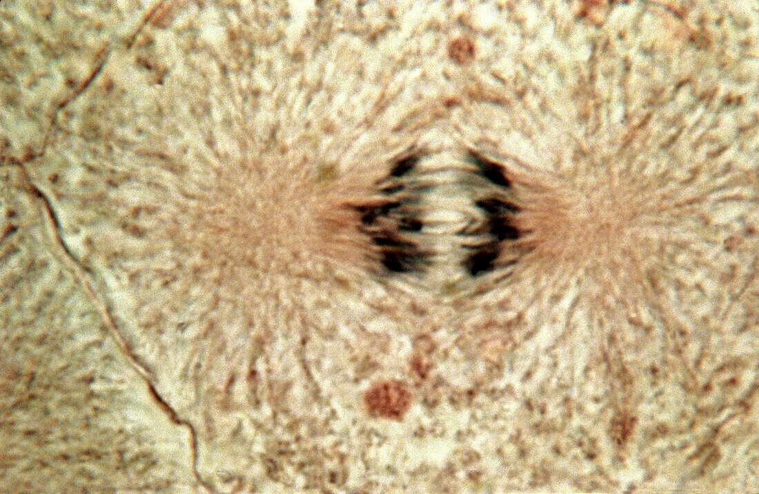 Dividing cell in anaphase stage of mitosis, light micrograph